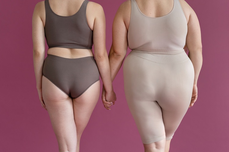 Lipedema
